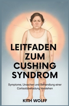 Paperback Leitfaden zum Cushing-Syndrom: Symptome, Ursachen und Behandlung einer Cortisolüberladung verstehen [German] Book