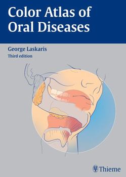 Hardcover Color Atlas of Oral Diseases Book