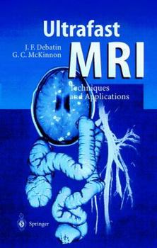 Hardcover Ultrafast MRI: Techniques and Applications Book