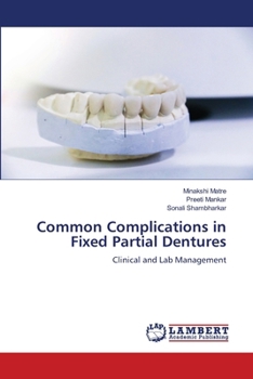 Paperback Common Complications in Fixed Partial Dentures Book