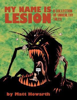 Paperback My Name Is Lesion: A Collection of Unhealthy Tales Book