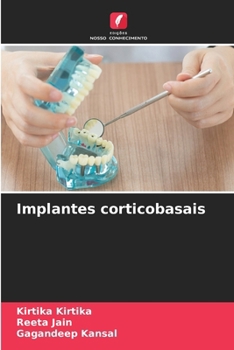 Paperback Implantes corticobasais [Portuguese] Book