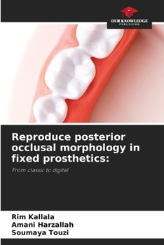 Paperback Reproduce posterior occlusal morphology in fixed prosthetics Book