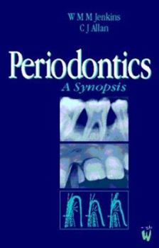 Paperback Periodontics: A Synopsis Book