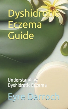 Paperback Dyshidrotic Eczema Guide: Understanding Dyshidrotic Eczema Book