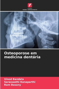 Paperback Osteoporose em medicina dentária [Portuguese] Book