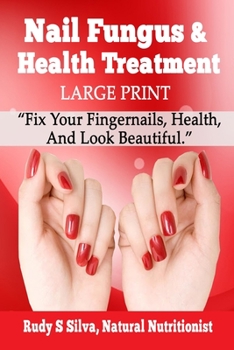 Paperback Nail Fungus and Health Treatment: Large Print: Fix Your Fingernail's Health And Look Beautiful [Large Print] Book