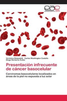 Paperback Presentación infrecuente de cáncer basocelular [Spanish] Book