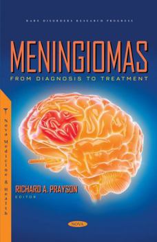 Paperback Meningiomas: From Diagnosis to Treatment Book