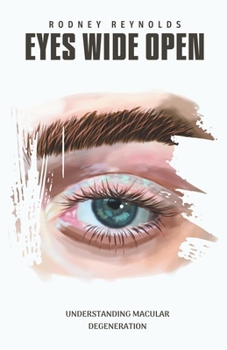 Paperback Eyes Wide Open: Understanding Macular Degeneration Book