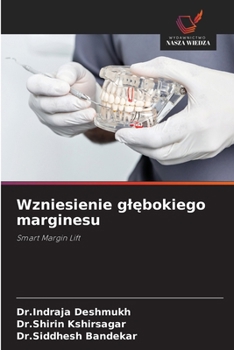 Wzniesienie glebokiego marginesu (Polish Edition)
