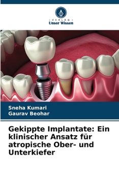 Gekippte Implantate: Ein klinischer Ansatz für atropische Ober- und Unterkiefer (German Edition)