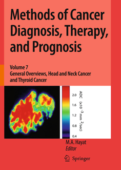 Paperback Methods of Cancer Diagnosis, Therapy, and Prognosis: General Overviews, Head and Neck Cancer and Thyroid Cancer Book