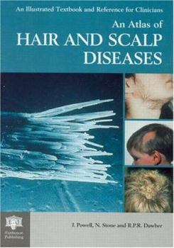 Hardcover An Atlas of Hair and Scalp Diseases Book