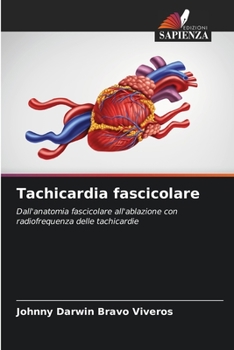 Tachicardia fascicolare