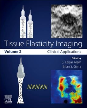 Paperback Tissue Elasticity Imaging: Volume 2: Clinical Applications Book
