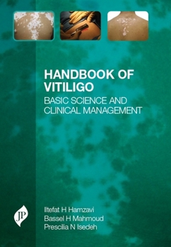 Hardcover Handbook of Vitiligo: Basic Science and Clinical Management Book