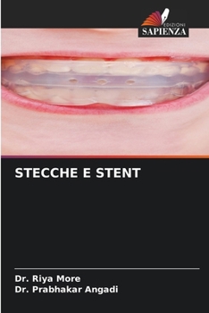 Paperback Stecche E Stent [Italian] Book