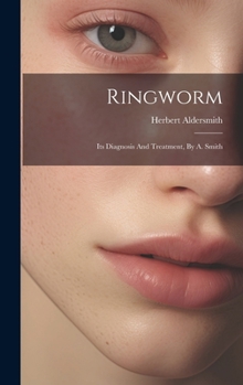 Hardcover Ringworm: Its Diagnosis And Treatment, By A. Smith Book