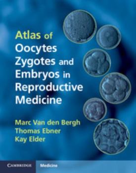 Hardcover Atlas of Oocytes, Zygotes and Embryos in Reproductive Medicine Hardback [With CDROM] Book