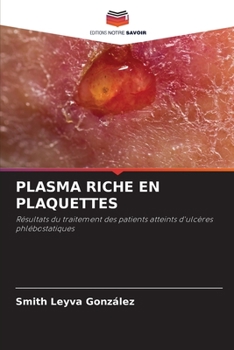 Paperback Plasma Riche En Plaquettes [French] Book