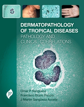 Hardcover Dermatopathology of Tropical Diseases Book