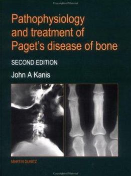 Hardcover Pathophysiology and Treatment of Paget's Disease of Bone Book