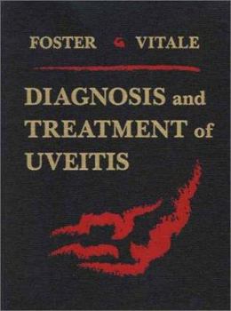 Hardcover Diagnosis and Treatment of Uveitis Book