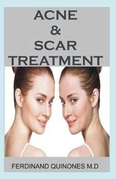 Paperback Acne & Scar Treatment: All You Need to about Curing Acne with Ease, Quickly and Naturally. Book