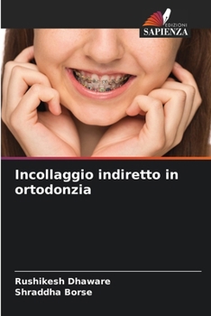 Incollaggio indiretto in ortodonzia (Italian Edition)