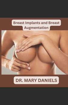 Paperback Breast Implants: Breast Augmentation and Boob jobs Book
