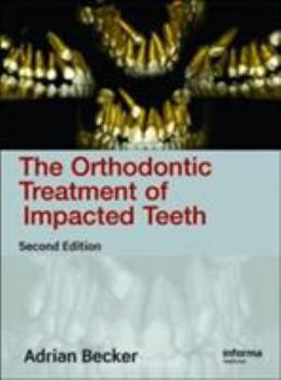 Hardcover Orthodontic Treatment of Impacted Teeth,Second Edition Book