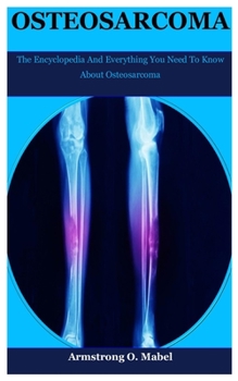 Paperback Osteosarcoma: The Encyclopedia And Everything You Need To Know About Osteosarcoma Book