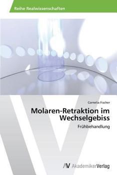 Paperback Molaren-Retraktion im Wechselgebiss [German] Book