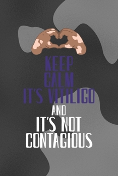 Keep Calm It's Vitiligo And It's Not contagious: Notebook Journal Composition Blank Lined Diary Notepad 120 Pages Paperback Black Texture Vitiligo