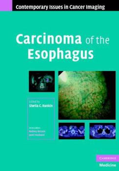 Hardcover Carcinoma of the Esophagus Book