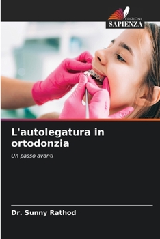 Paperback L'autolegatura in ortodonzia [Italian] Book