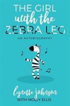 Paperback The Girl with the Zebra Leg: An Autobiography Book