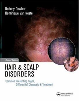 Hardcover Hair and Scalp Disorders: Common Presenting Signs, Differential Diagnosis Book