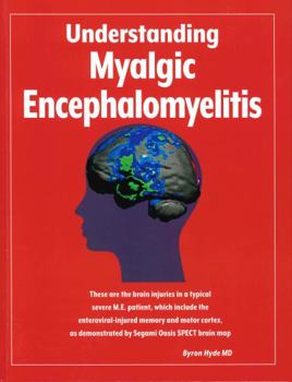 Hardcover Understanding Myalgic Encephalomyelitis Book