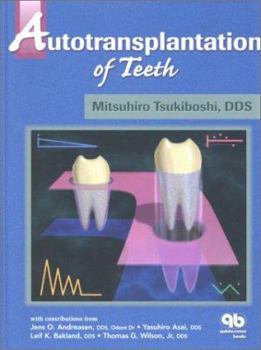 Hardcover Autotransplantation of Teeth: Book