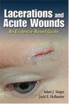 Paperback Lacerations and Acute Wounds: An Evidence-Based Guide Book