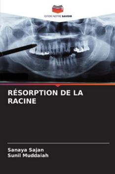 Paperback Résorption de la Racine [French] Book