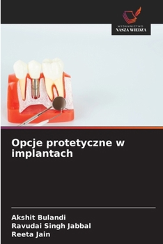 Opcje protetyczne w implantach (Polish Edition)
