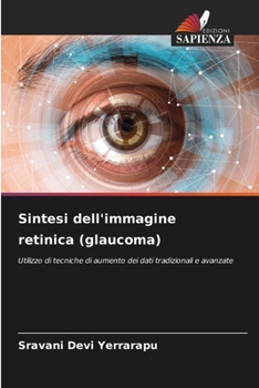 Paperback Sintesi dell'immagine retinica (glaucoma) [Italian] Book