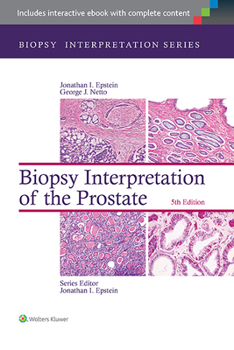 Hardcover Biopsy Interpretation of the Prostate Book