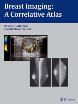 Hardcover Breast Imaging [German] Book