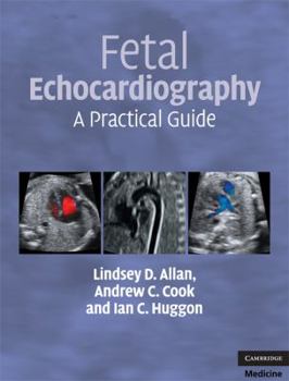 Hardcover Fetal Echocardiography: A Practical Guide [With DVD] Book