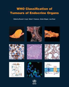 Paperback Who Classification of Tumours of Endocrine Organs Book