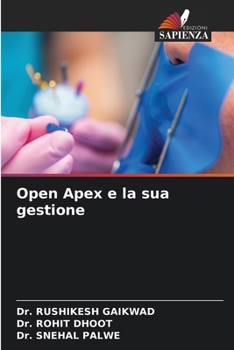 Paperback Open Apex e la sua gestione [Italian] Book